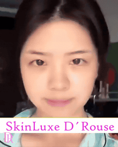 SkinLuxe